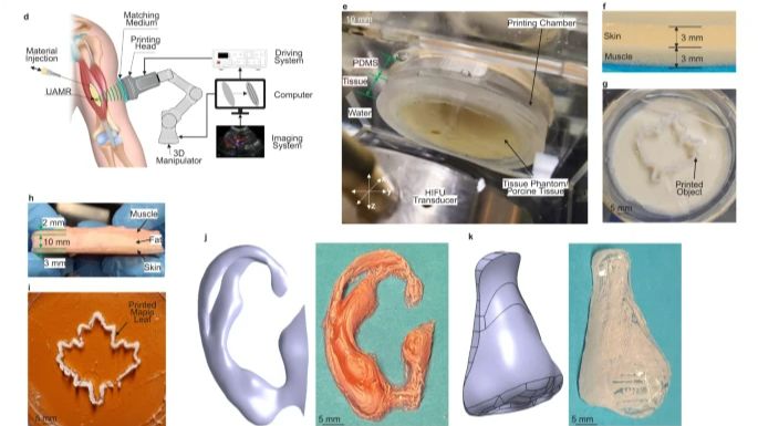 3D-печать звуковыми волнами (DSP) – будущее медицины