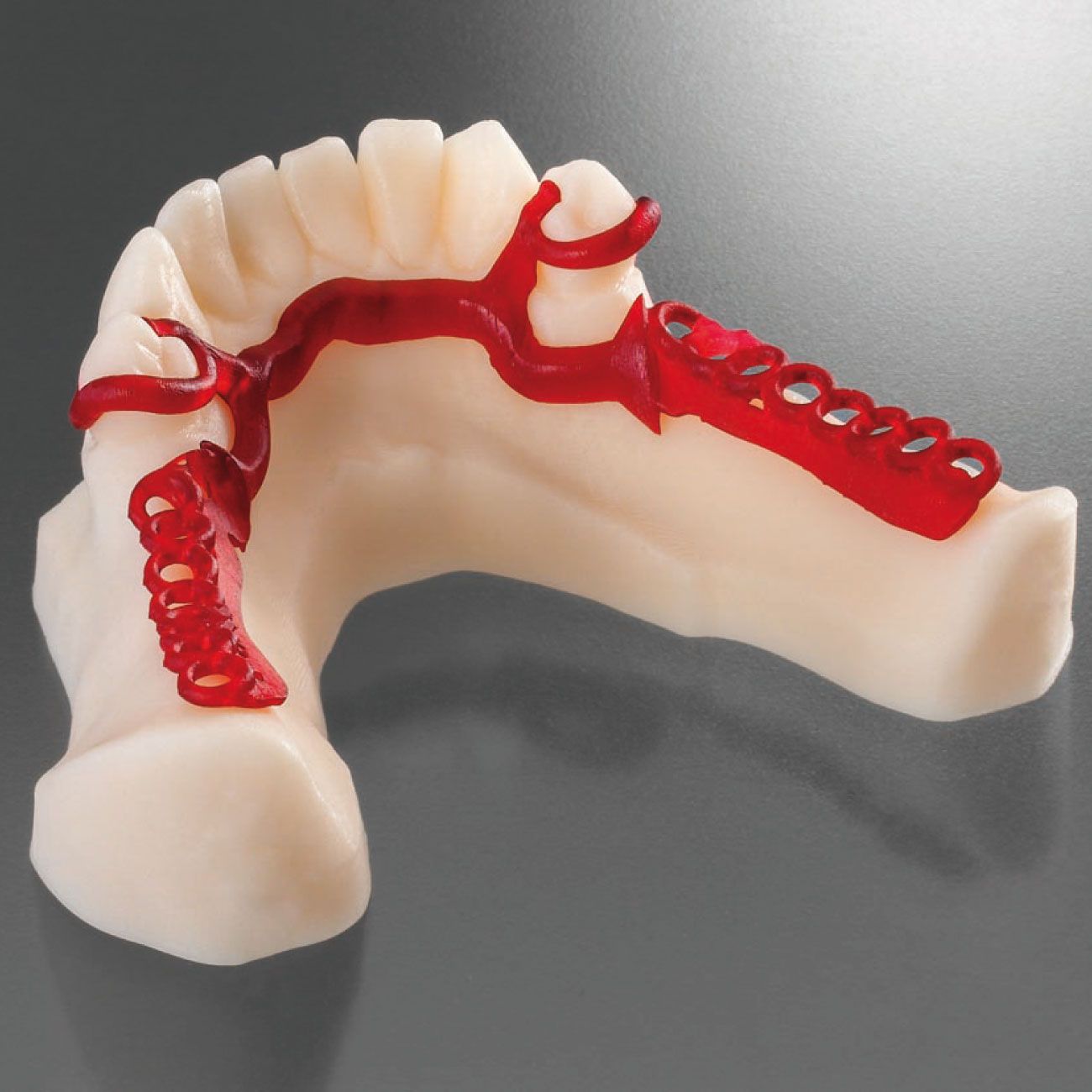 Накладка из DETAX Freeprint cast UV