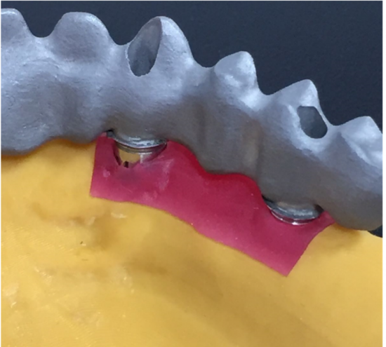 Часть десны, изготовленная из NextDent Gingiva Mask
