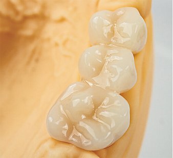 Лак HARZ Labs Dental Glaze, 10 мл