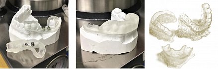 Фотополимерная смола HARZ Labs Dental Clear, прозрачный (1 кг)